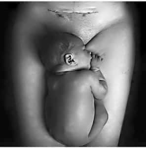 How Many C-Sections Are Safely Possible?