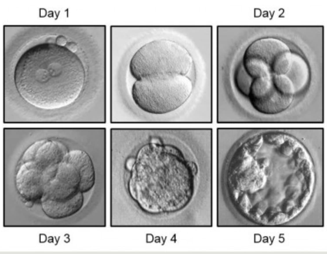 IVF-patient education