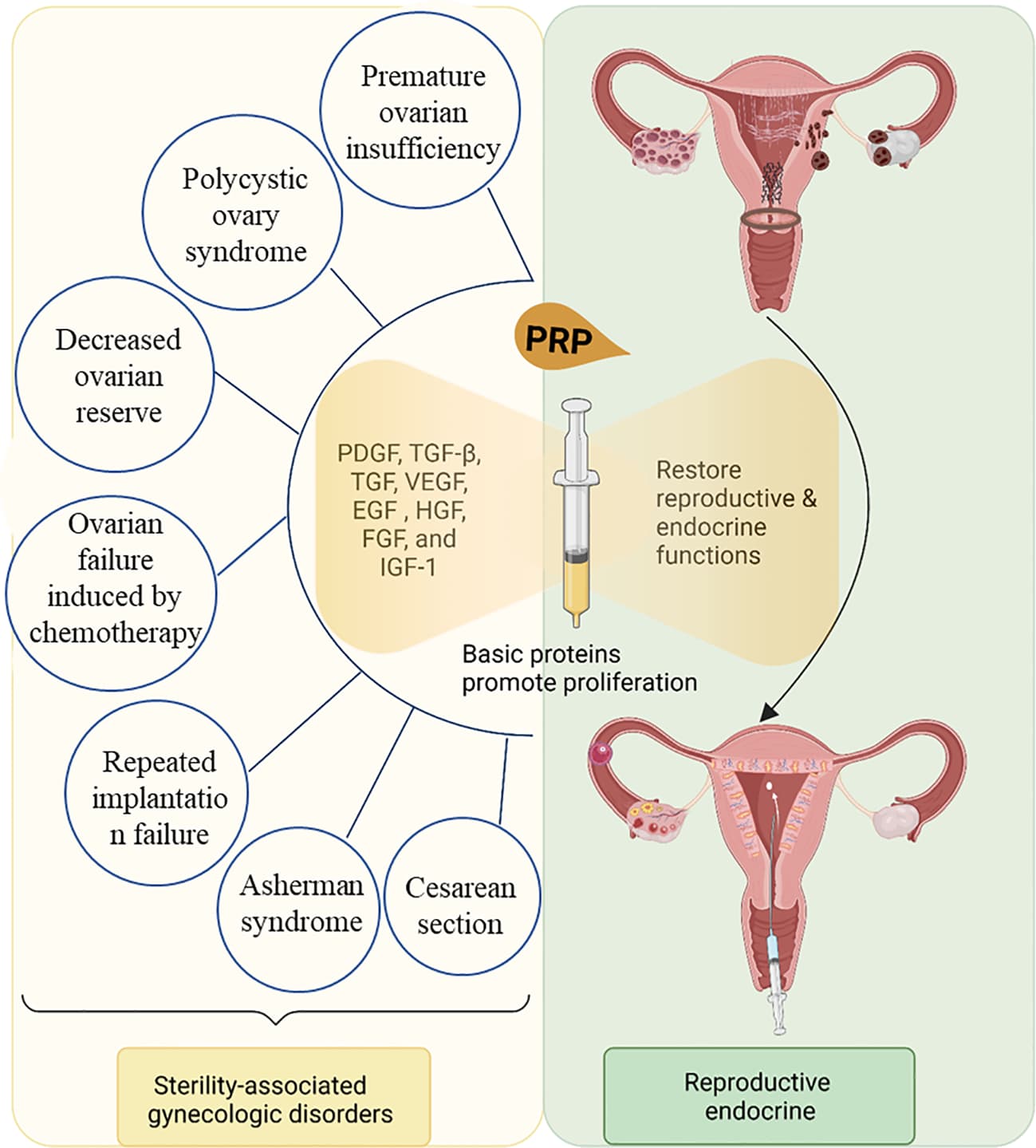 Ovarian Rejuvenation with PRP