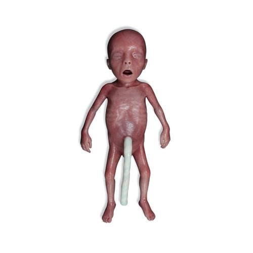 Caring for Your Low Birth Weight (LBW) Baby
